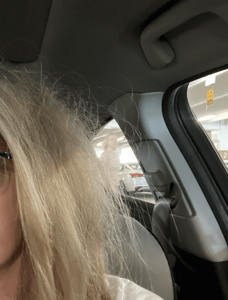 Ultimate Hair Dynamics - hair transplant in San Diego, CA