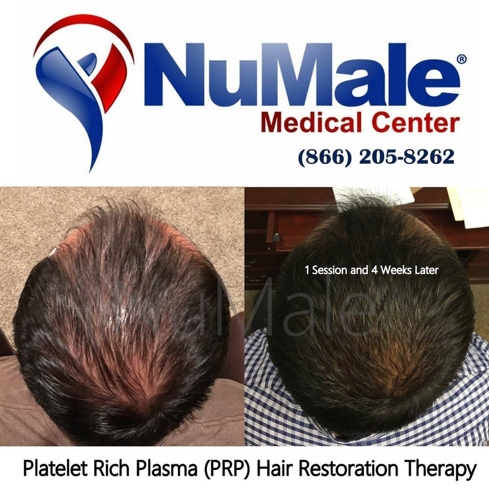 NuMale Medical Center - hair transplant in Wauwatosa, WI