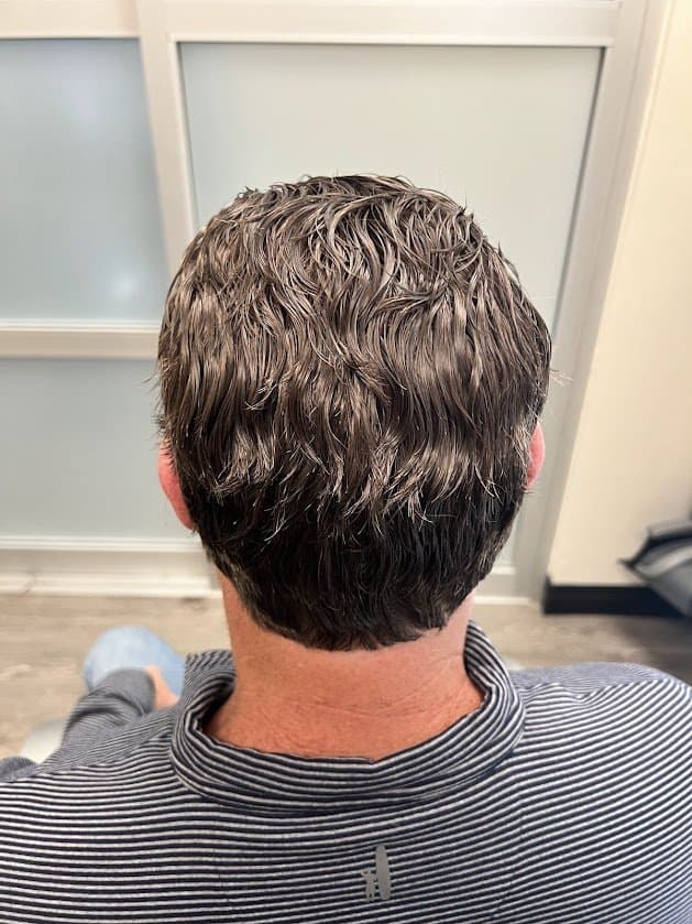 House of Peruke - hair transplant in Livonia, MI