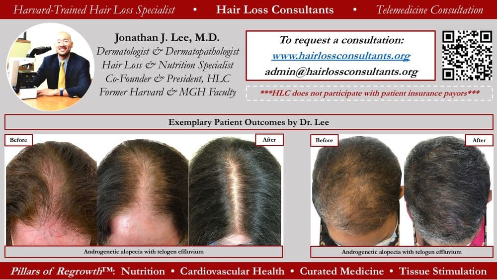 Hair Loss Consultants - hair transplant in Bethesda, MD