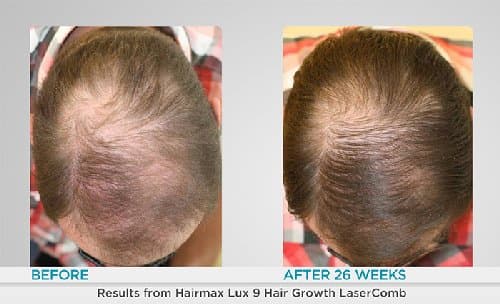 I Am Beautiful Hair Restoration Clinic - hair transplant in Farmington Hills, MI