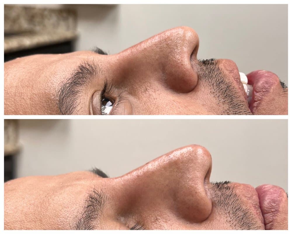 Mansfield Aesthetics - hair transplant in Mansfield, TX