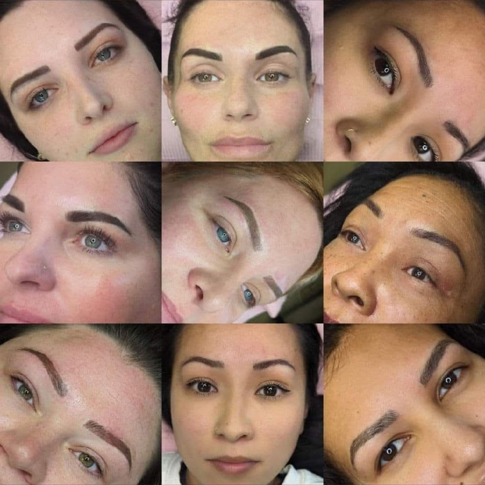 Kansas City Beauty Solutions - hair transplant in Kansas City, MO