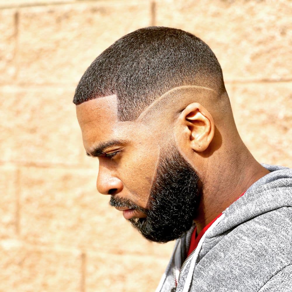 Pat The Barber - hair transplant in Sandy Springs, GA