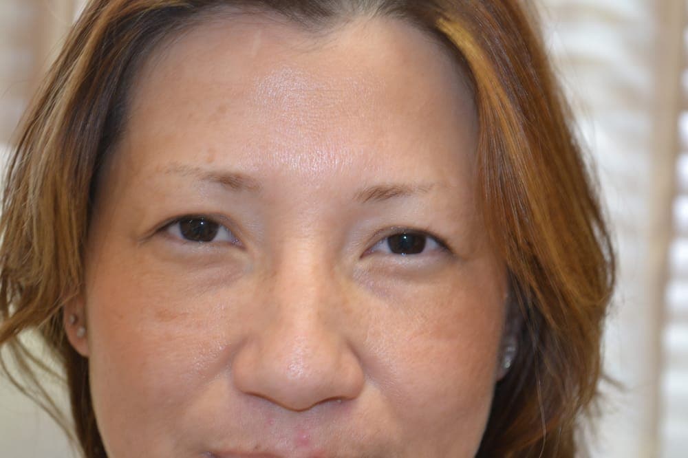 Permanent Makeup By Manny - hair transplant in Miami, FL