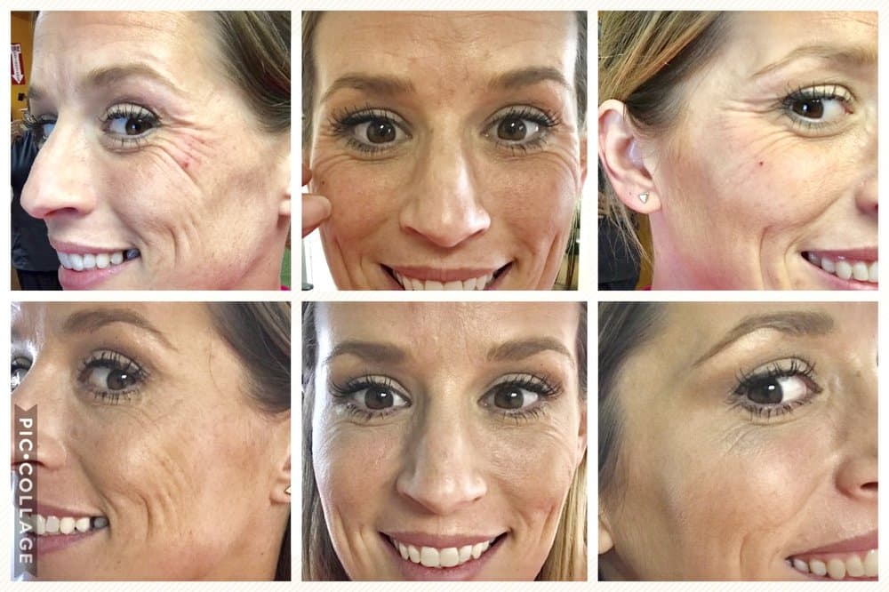 Ten Years Younger - hair transplant in Houston, TX