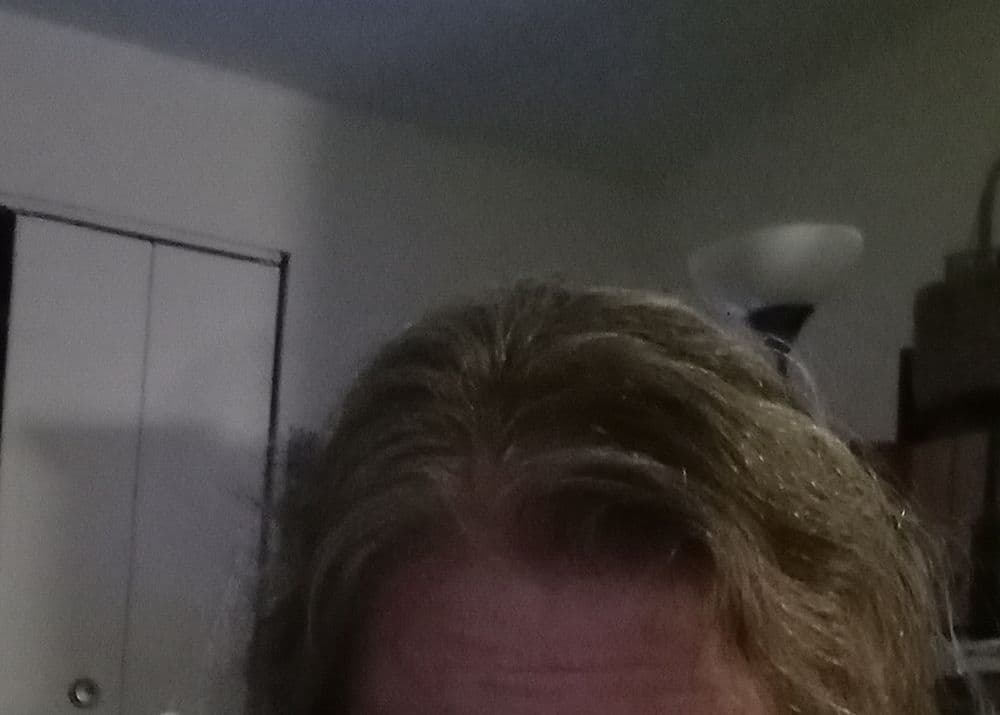 Laser Hair & Scalp Clinic - hair transplant in Clearwater, FL