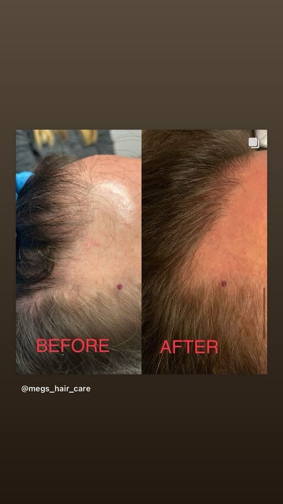 Radiant Ridge Wellness - hair transplant in Centennial, CO