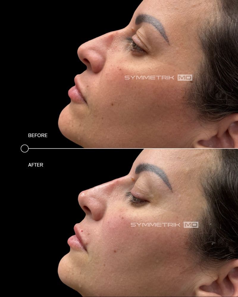 Symmetrik MD - hair transplant in Miami, FL