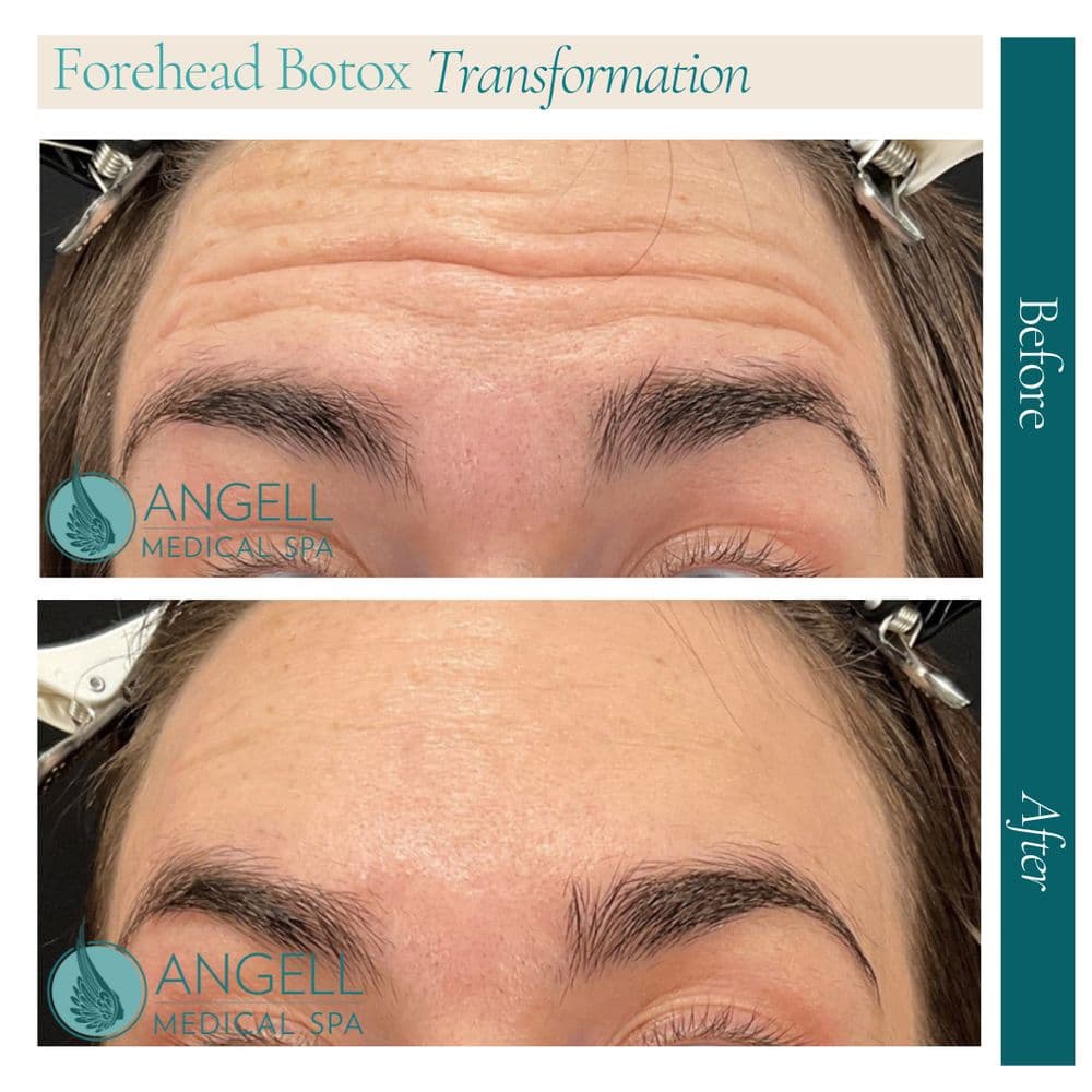 Angell Medical Spa - hair transplant in Sacramento, CA