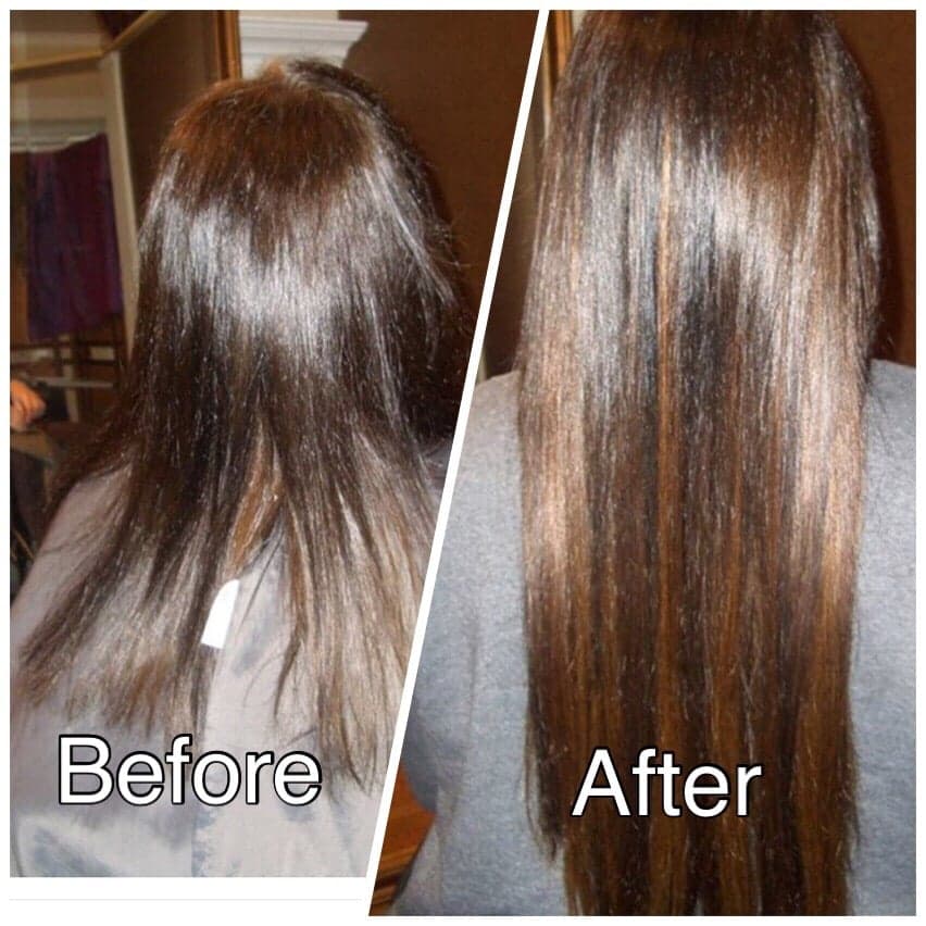 Excellength - hair transplant in Atlanta, GA