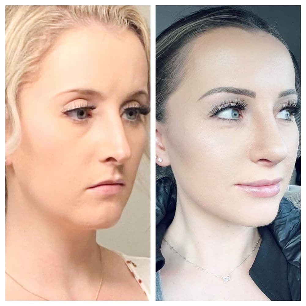 JMISKO Surgical Design md - hair transplant in Omaha, NE