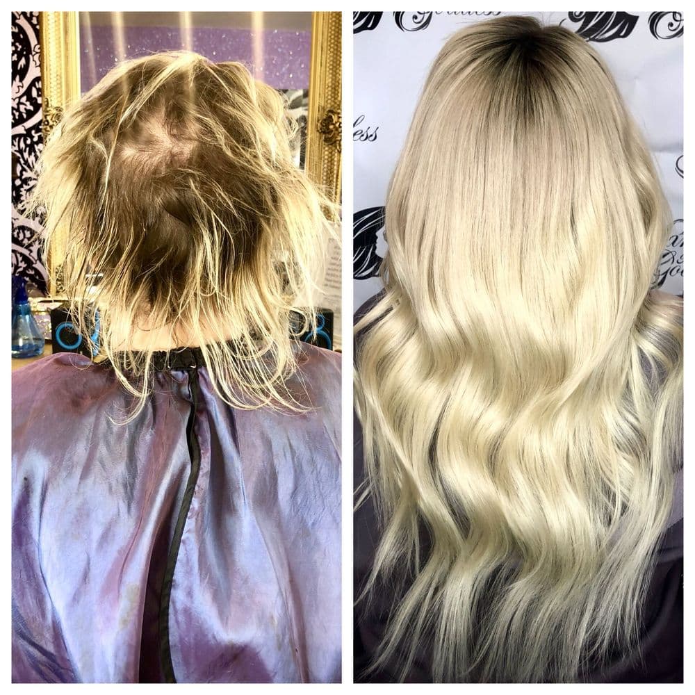 Hair Extensions Cherry Creek - hair transplant in Denver, CO