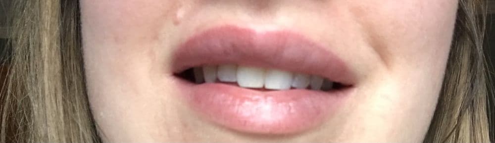 Bloom Facial Plastic Surgery - hair transplant in Bryn Mawr, PA