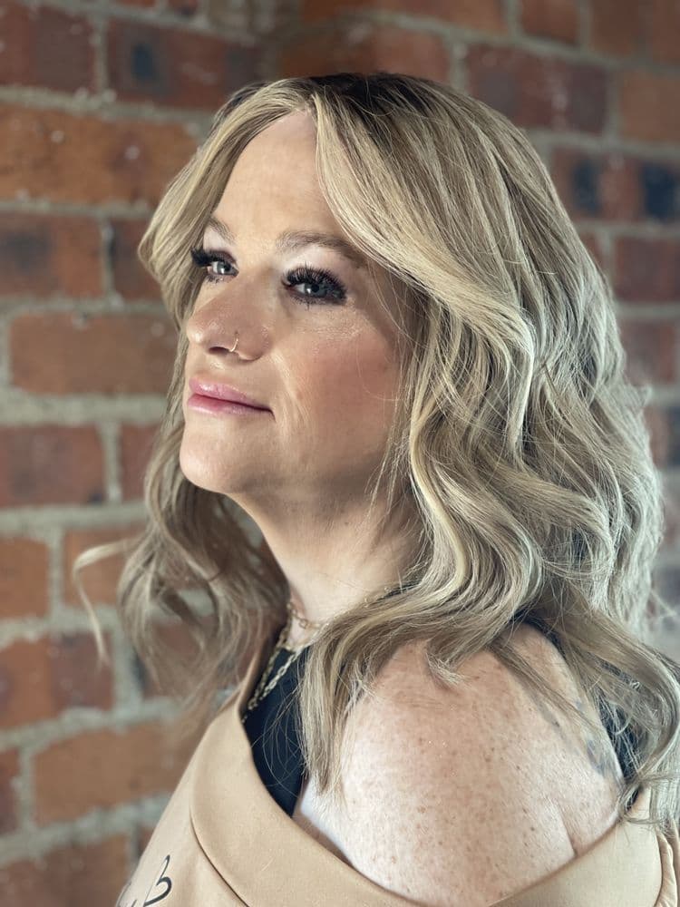 The Hair Replacement Studio - hair transplant in Fort Worth, TX