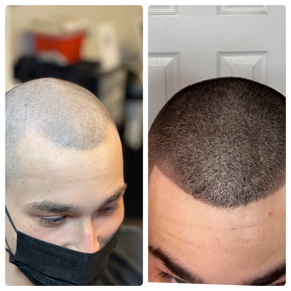 Executive Scalp Micropigmentation - hair transplant in Portsmouth, VA
