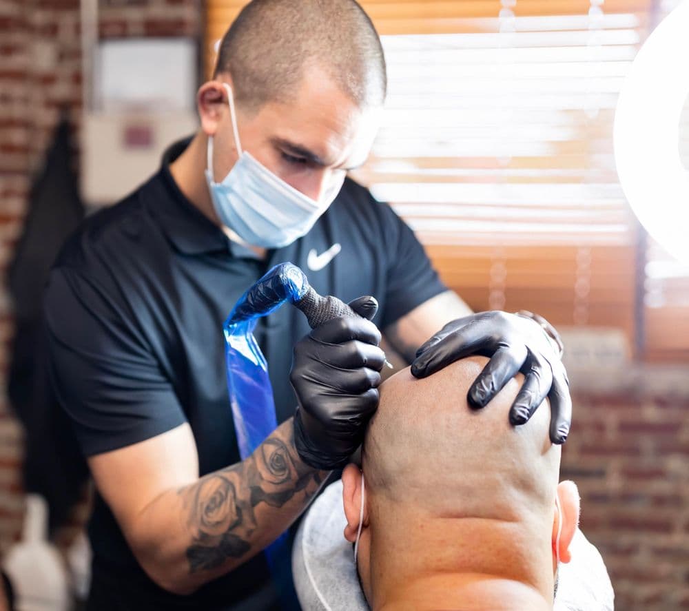 Scalp-Medic - hair transplant in Johns Creek, GA