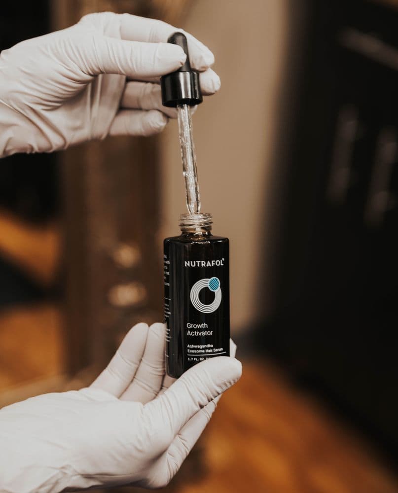 Patty Fitzsimmons Hair - hair transplant in Minneapolis, MN