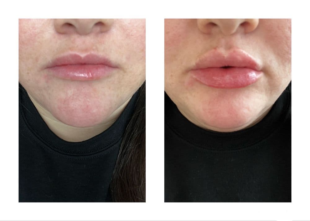 JT Aesthetics - hair transplant in Ridgefield , CT