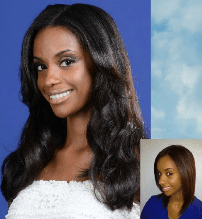 Hair Therapy For Women - hair transplant in Tampa, FL