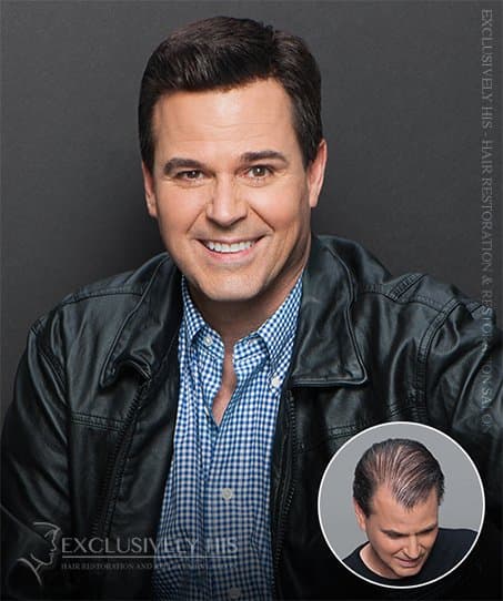 Hair Specialists - Lincoln - hair transplant in Lincoln, NE