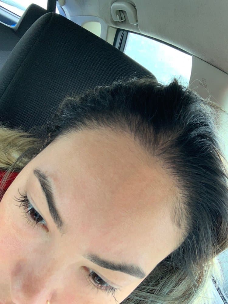 Mollura Medical Hair Restoration - hair transplant in Franklin Square, NY