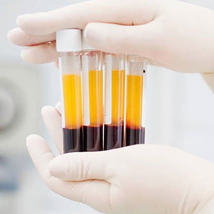 Needles & Tox - hair transplant in Greenwood Village, CO