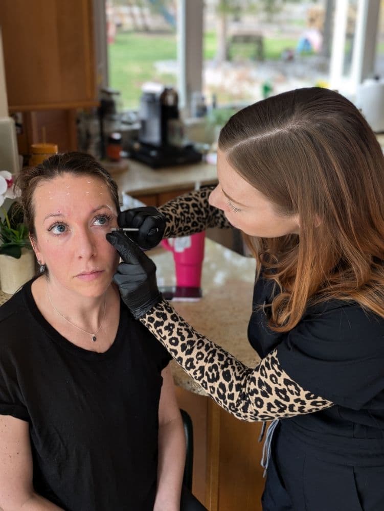 Skin Solutions by Colleen - hair transplant in Flemington, NJ