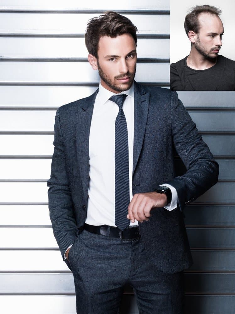 MHN Hair Restoration Studio - hair transplant in Queens, NY