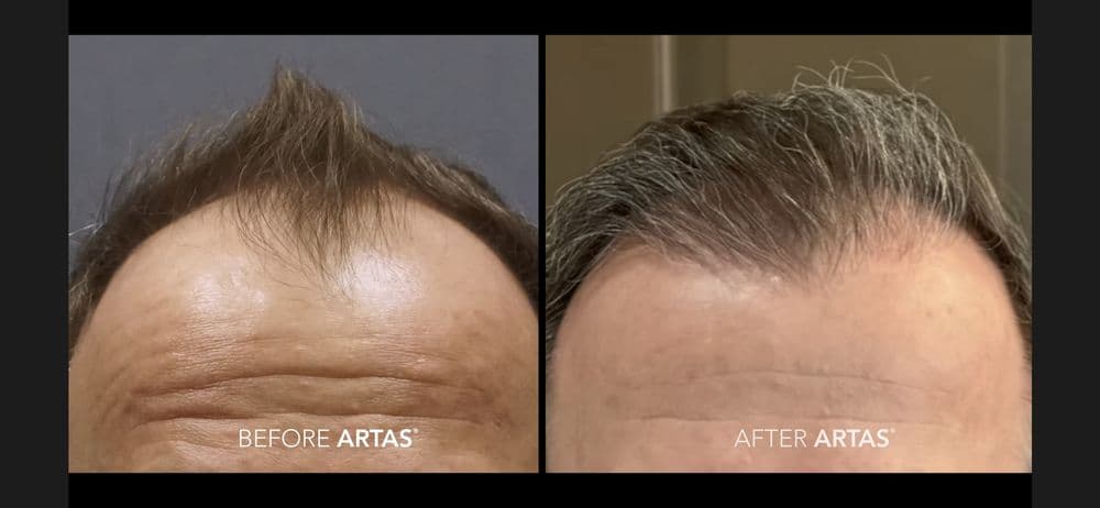 Fallon Hair Restoration - hair transplant in Tigard, OR