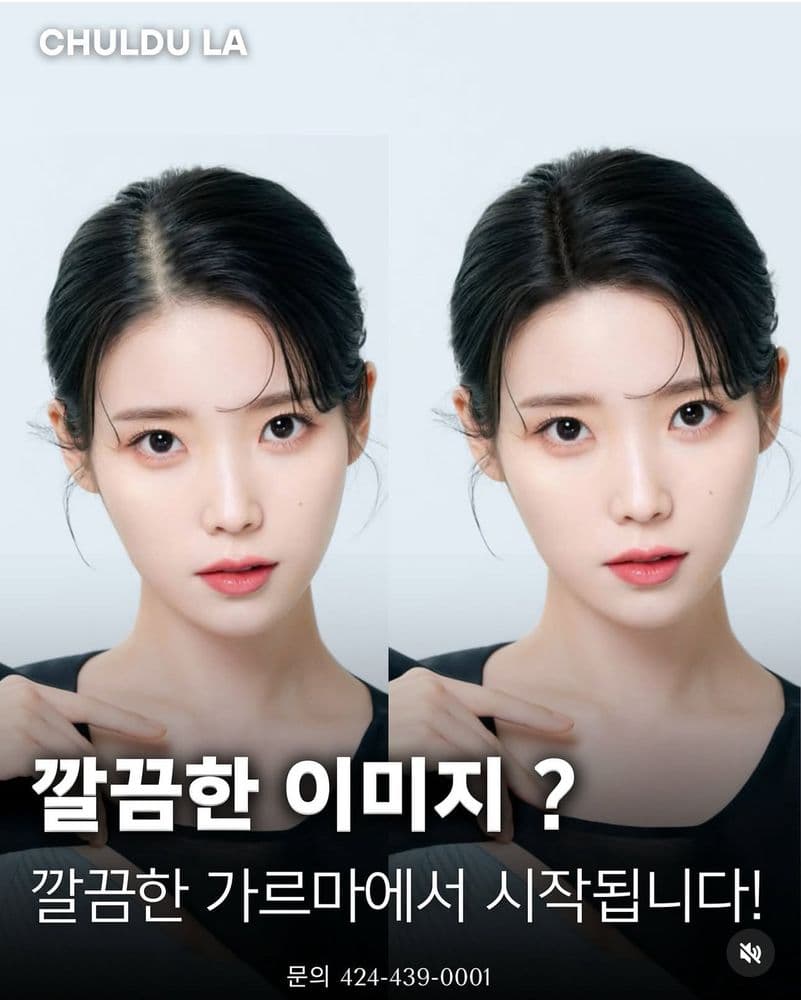 Chuldu Scalp Micropigmentation - hair transplant in Los Angeles, CA