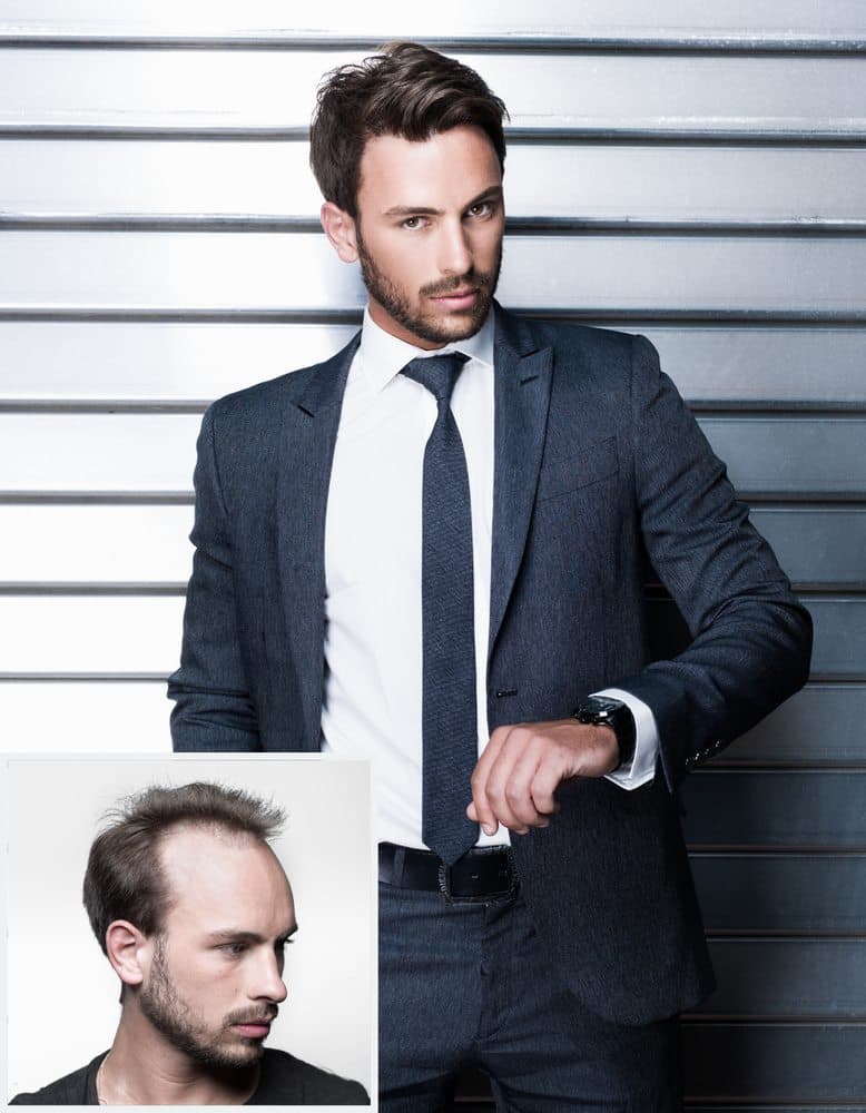 Images International - hair transplant in Bingham Farms, MI