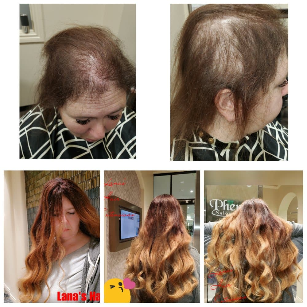 Lana's Hair Extensions - hair transplant in Sumner, WA
