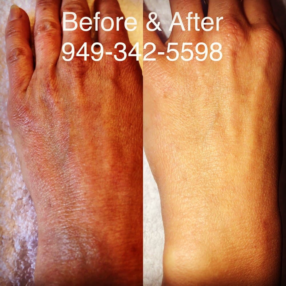 PRP Medical Clinic - hair transplant in Arlington, TX