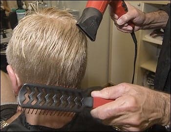 Lawrence Revere - hair transplant in Washington, DC, DC