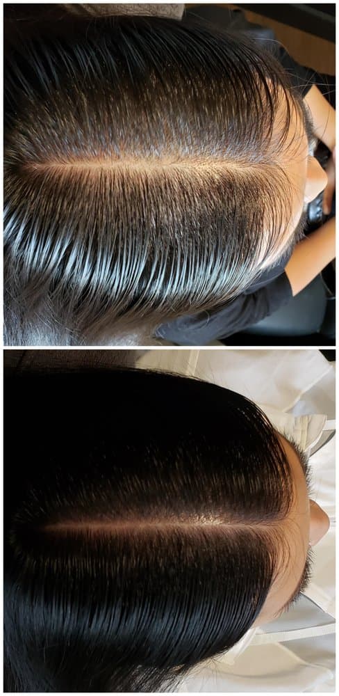 Damo Hair Loss Solution - hair transplant in Buena Park, CA