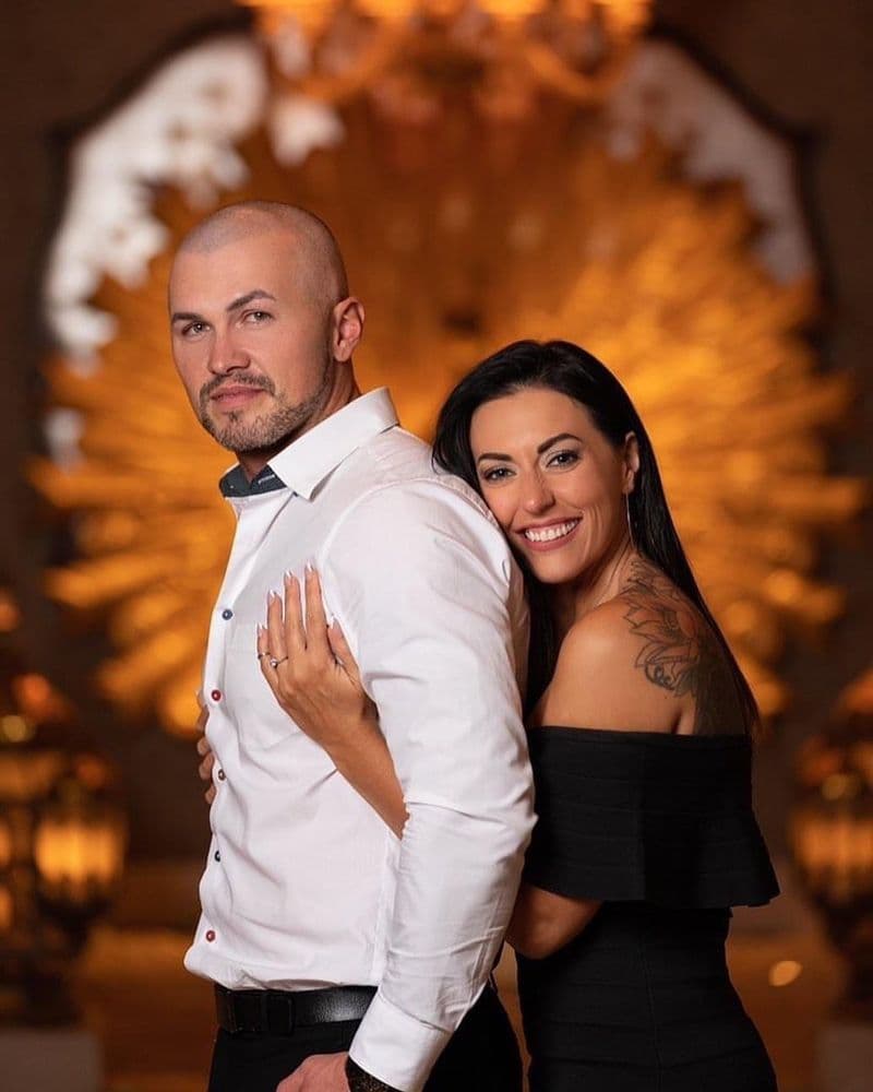 Scalp Prodigy - hair transplant in San Jose, CA