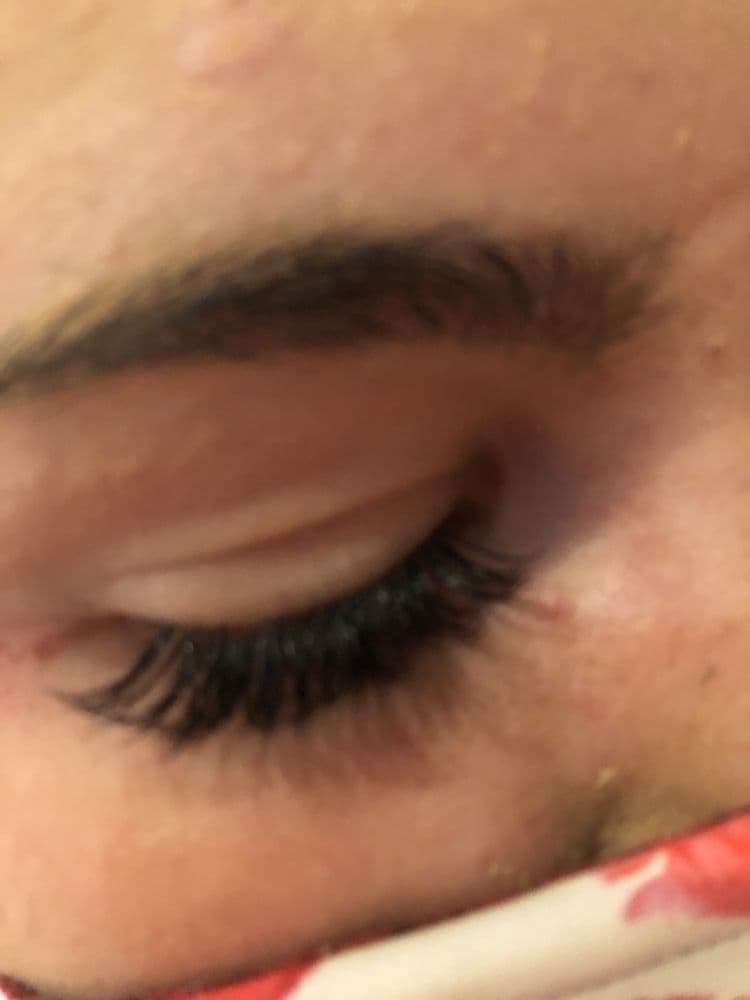 Lush Lash - hair transplant in Altamonte Springs, FL