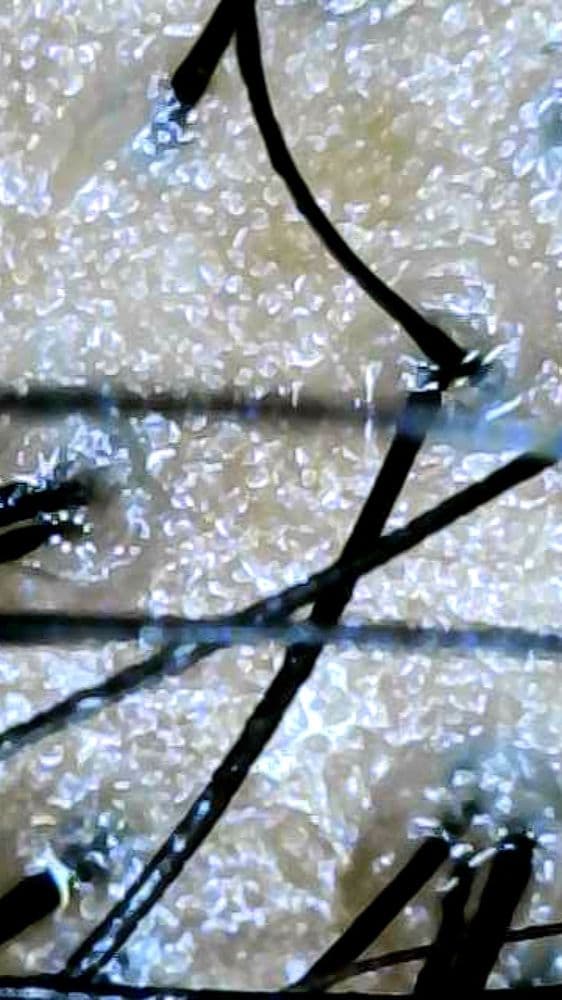 The Healthy Hair Spa - hair transplant in Arden-Arcade, CA