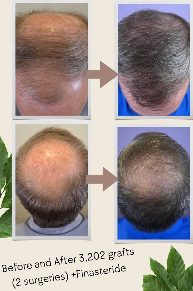 Nicole Rogers, MD, FAAD - Hair Restoration of the South - hair transplant in Metairie, LA