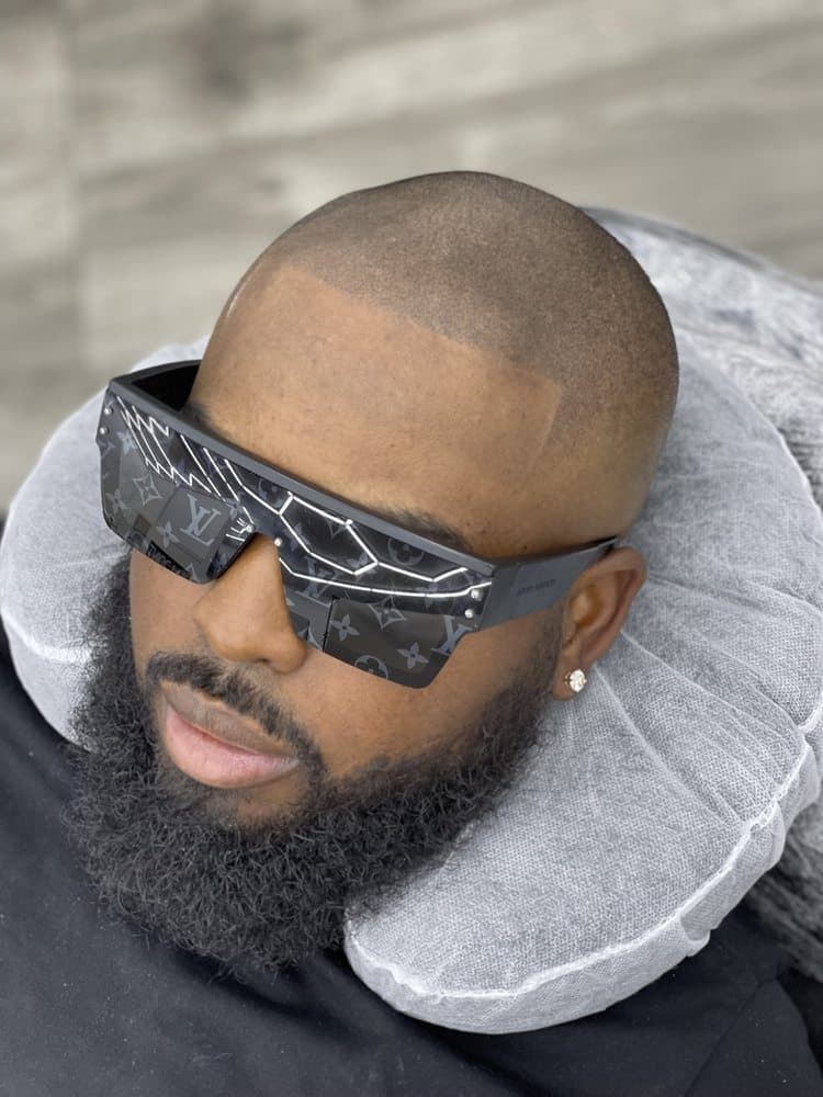 On Point SMP - hair transplant in Bellflower, CA