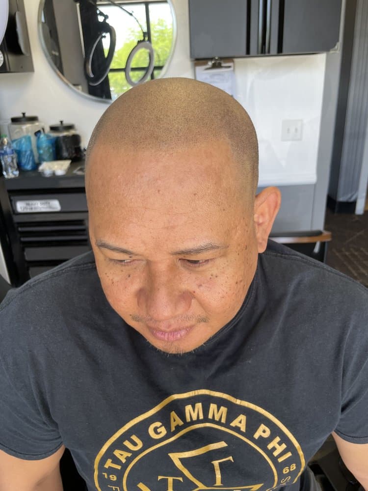 Vegas Scalp Micropigmentation - hair transplant in Spring Valley, NV