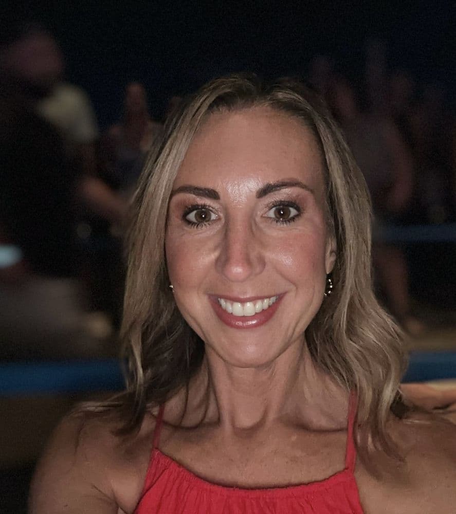 Renew Image - hair transplant in West Chester, OH