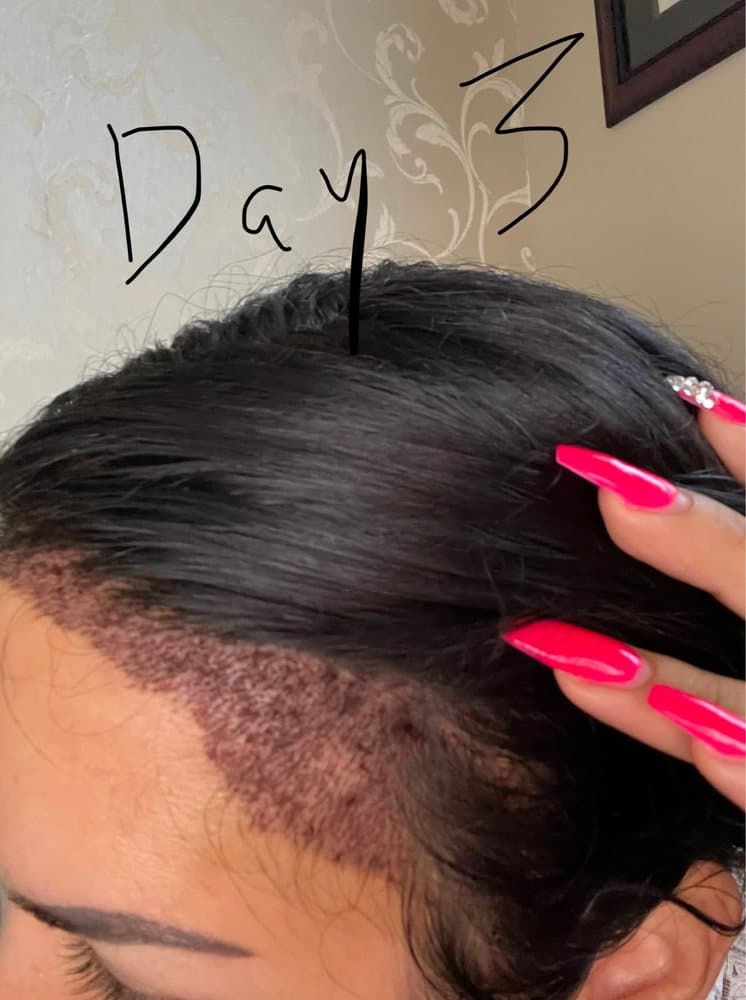 Biltmore Surgical Hair Restoration - hair transplant in Phoenix, AZ