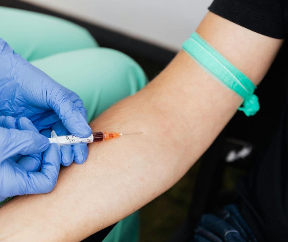 BWell Clinic - hair transplant in Plano, TX