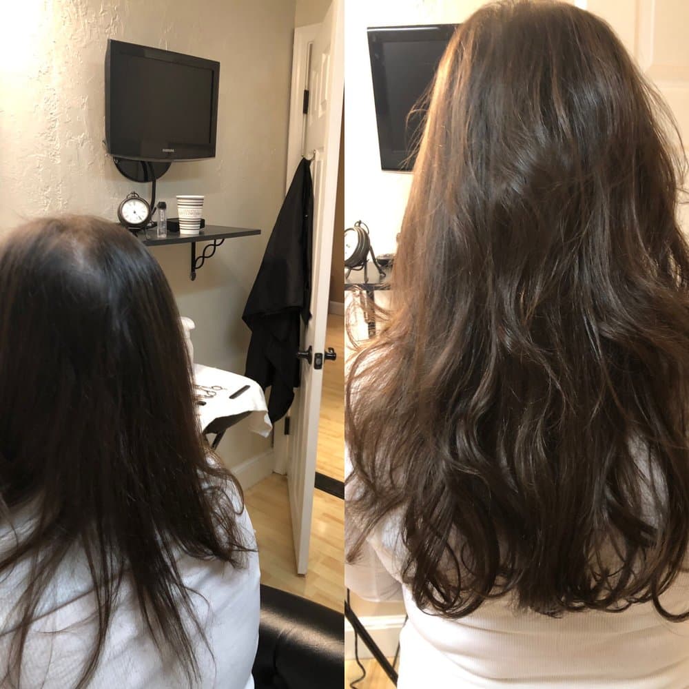 Personal Image - hair transplant in Needham, MA