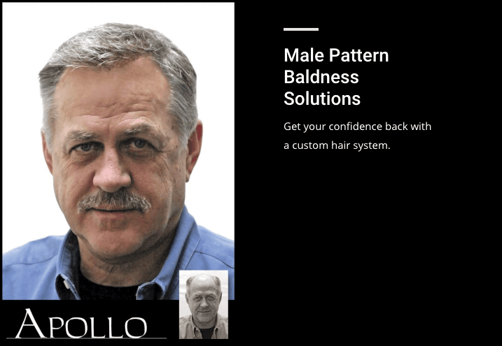 A New You Hair Center for Men and Women - hair transplant in Little Rock, AR