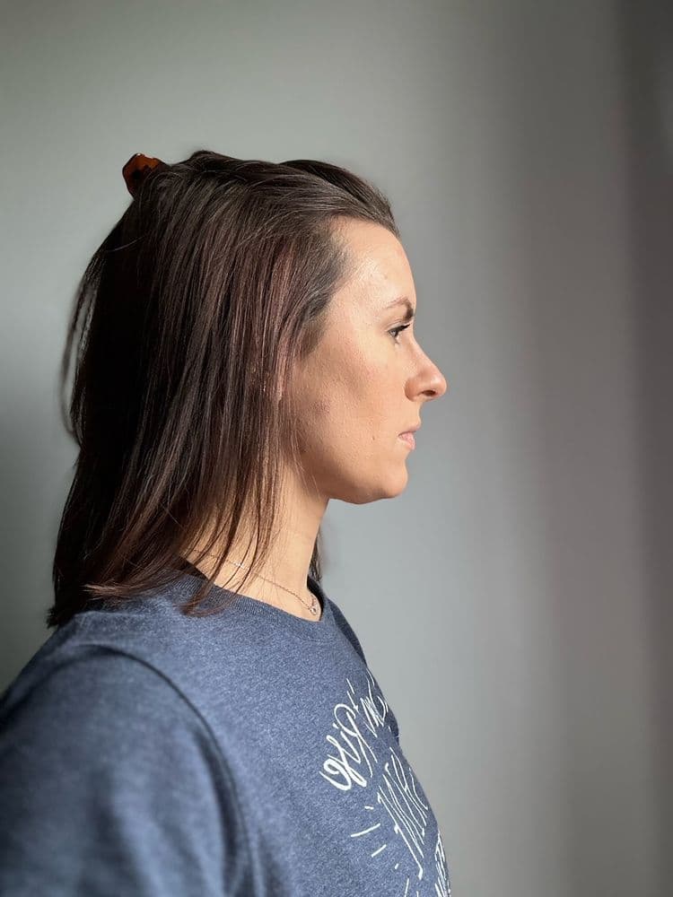 National Hair Loss Medical Aesthetics - hair transplant in Scottsdale, AZ