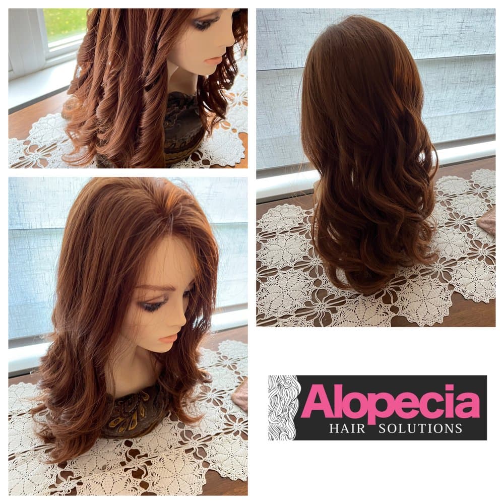 Alopecia Hair Solutions - hair transplant in Batavia, IL