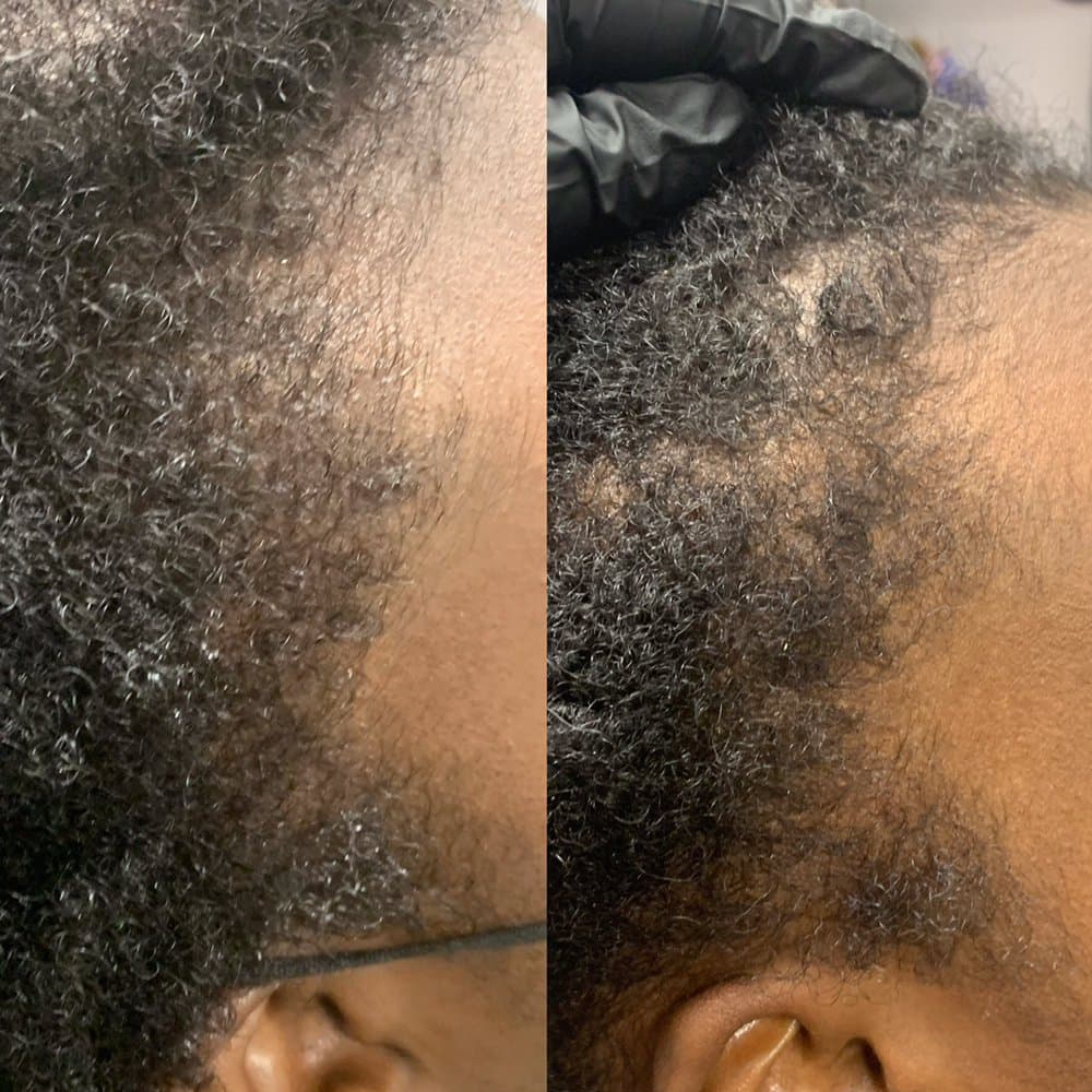 Dream Images Salon With Hair Dr Roberts - hair transplant in Round Rock, TX